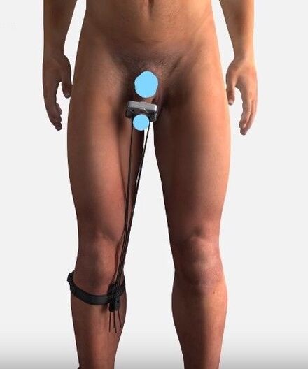 Member to increase the device