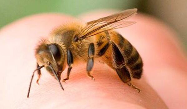Bee bite - an extreme means of enlarging the phallus